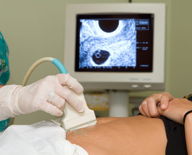 Legalizan homicidio con la despenalización del aborto