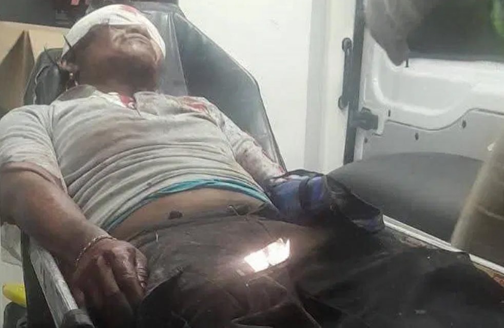 Agresión con arma blanca moviliza a autoridades