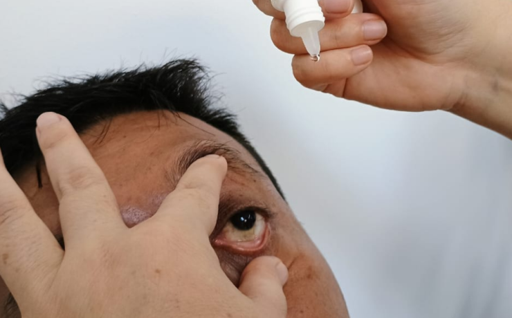 Descartan alerta por conjuntivitis en Campeche