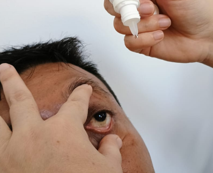 Descartan alerta por conjuntivitis en Campeche
