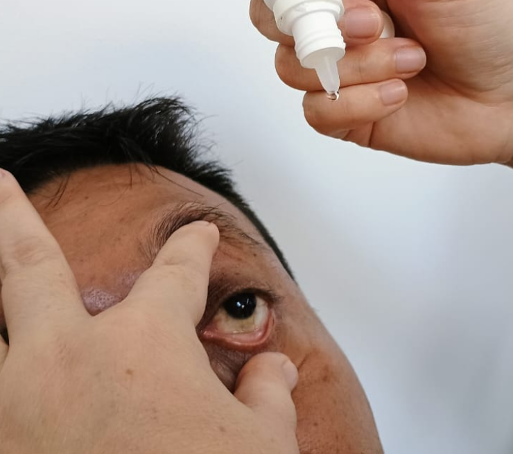 Descartan alerta por conjuntivitis en Campeche