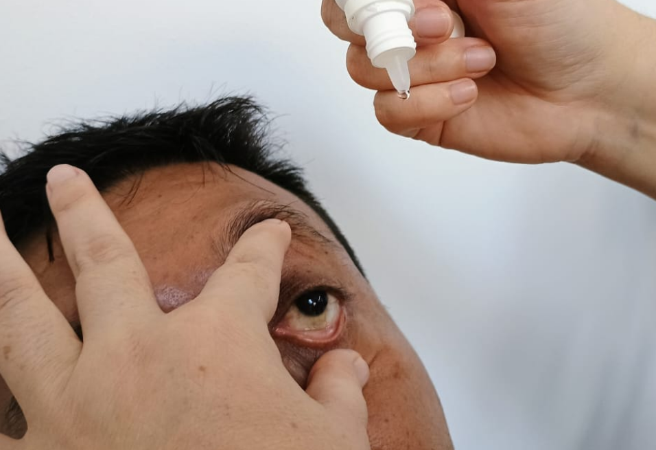 Descartan alerta por conjuntivitis en Campeche